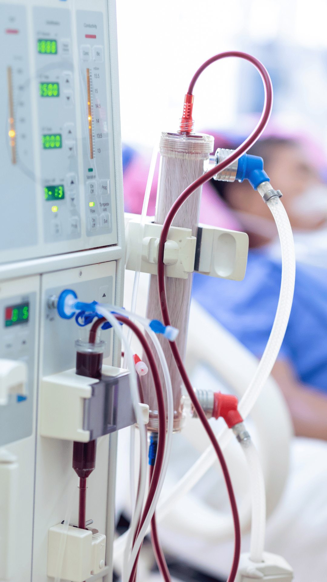A patient in a hospital bed connected to an IV machine, showing he is undergoing medical care.